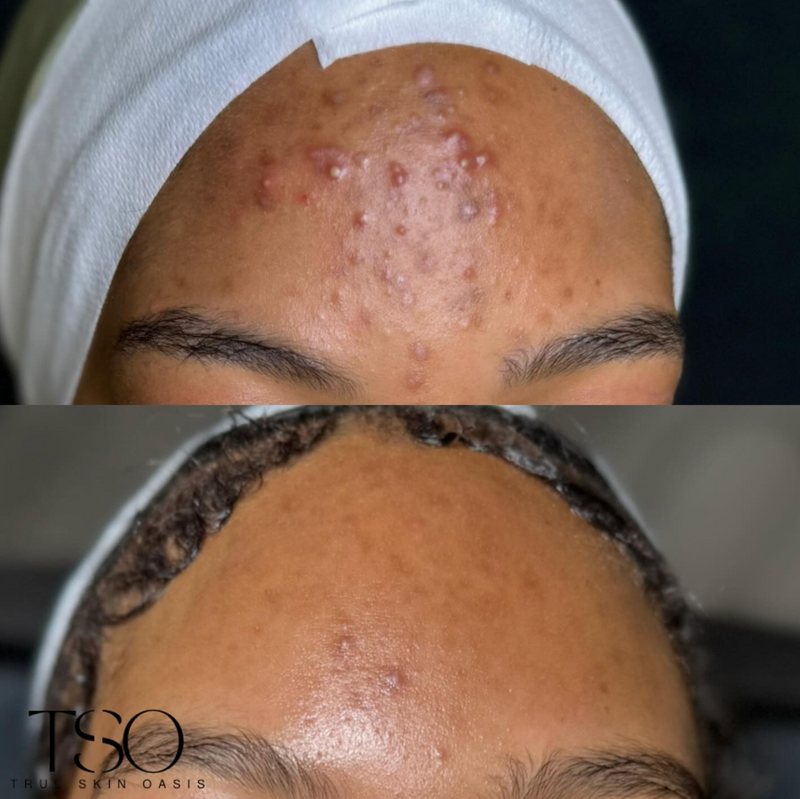 Skin Ripping Transformation Transformations – True Skin Oasis